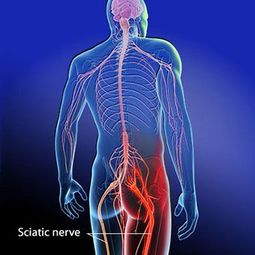 Sciatica and Low Back Pain Treatment